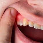 what is the strongest natural antibiotic for tooth infection